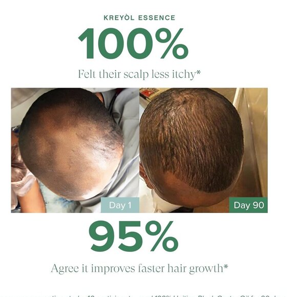 Kreyol Essence Mens Pure Haitian Black Castor Oil Skin Hair Scalp Care - Picture 4 of 6